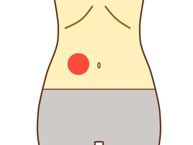 尺沢が合いやすいサインとして、お臍の右側を押すと痛みが出るポイント
