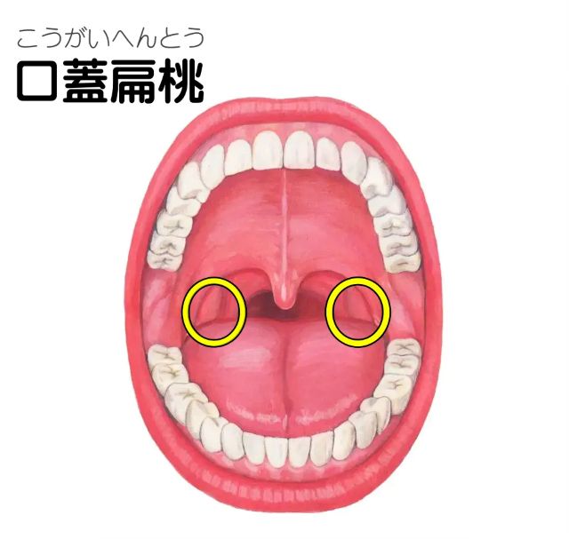 口蓋扁桃の位置の図