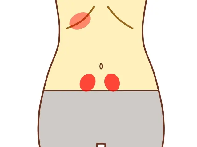 更年期障害による腹診の反応点