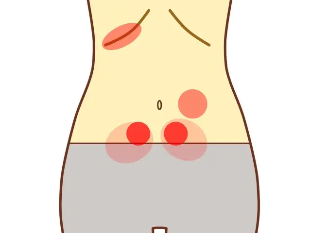 更年期障害による腹診の反応点