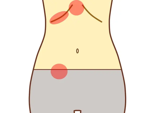 更年期障害による腹診の反応点