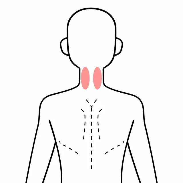 後頭部から首にかけての痛みの位置を示す人体図