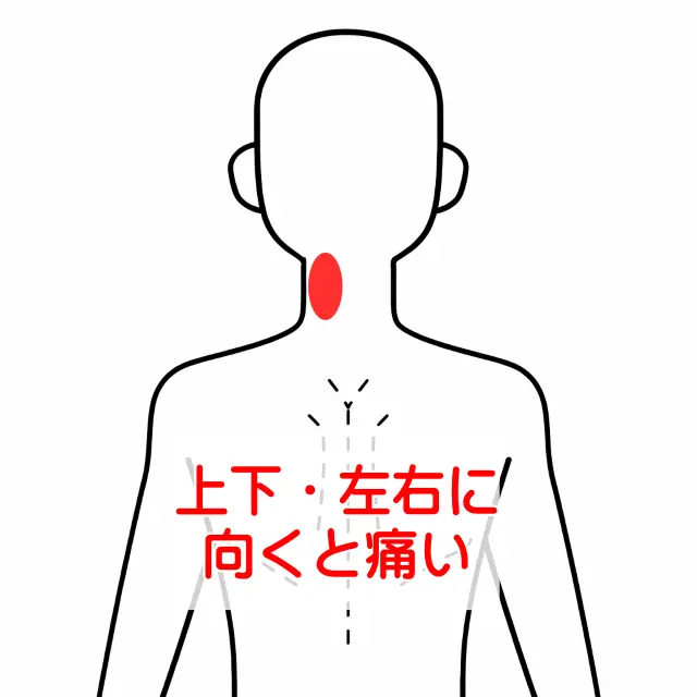 2ヶ月続いた首の痛みの部位を示す人体図