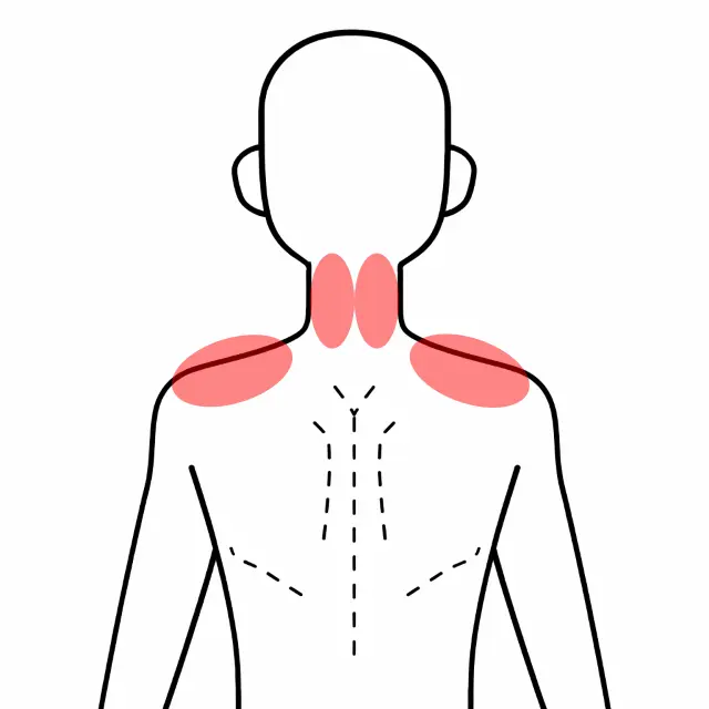 更年期障害で起きた不調の位置を示す人体図