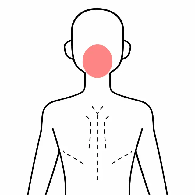 更年期障害で起きた頭痛の場所を示すイラスト