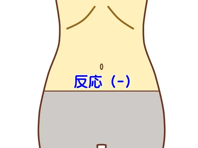 腹診で用いられる体表の反応部位の一例