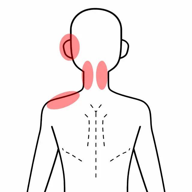 耳や肩まわりの違和感を感じる位置を示したイメージ図