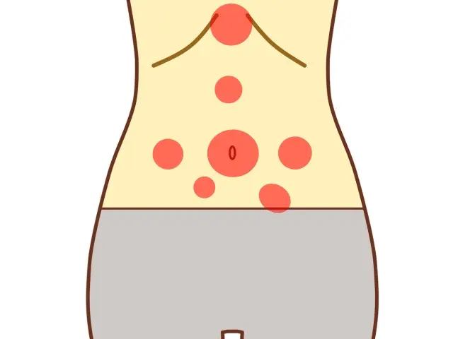 腹診で用いられる体表の反応部位の一例