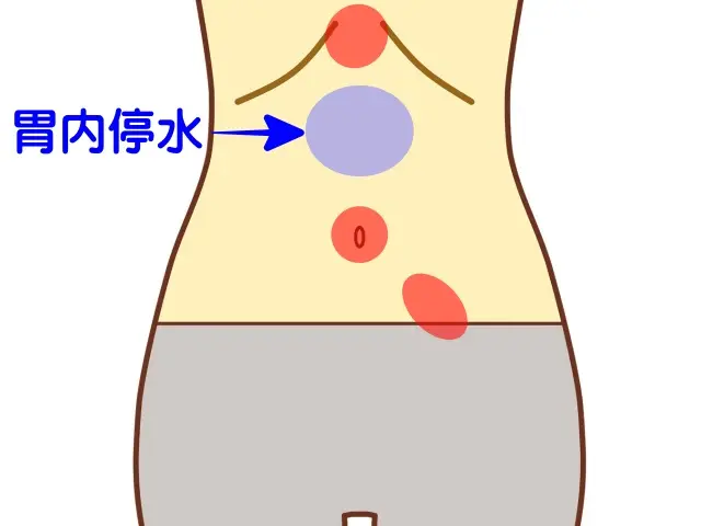 腹診で用いられる体表の反応部位の一例