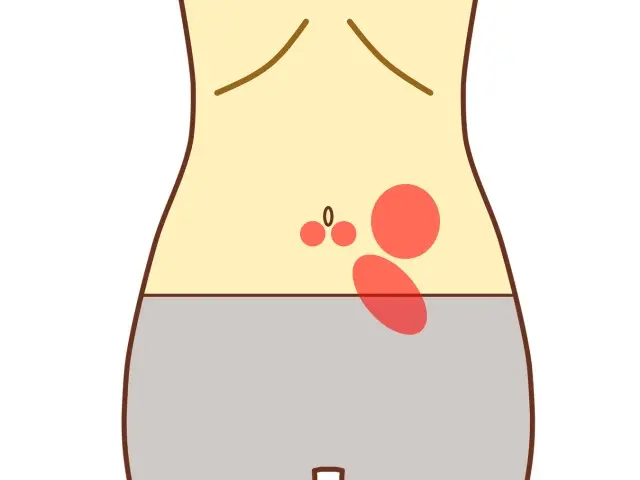 腹診で用いられる体表の反応部位の一例