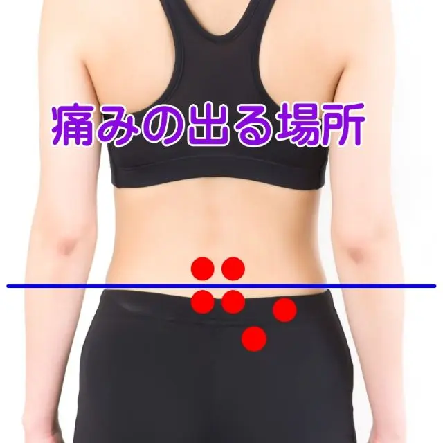 椎間関節性腰痛の痛みの部位