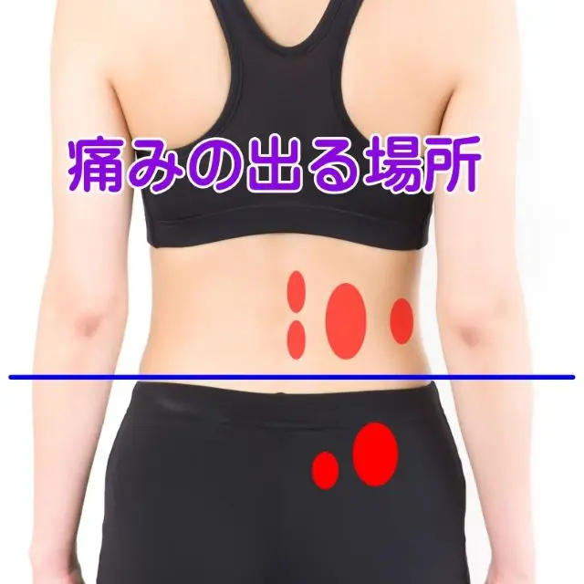 筋・筋膜性腰痛の痛の部位