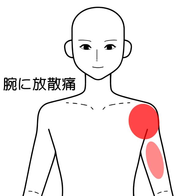 左肩の痛みの位置を示した後面図