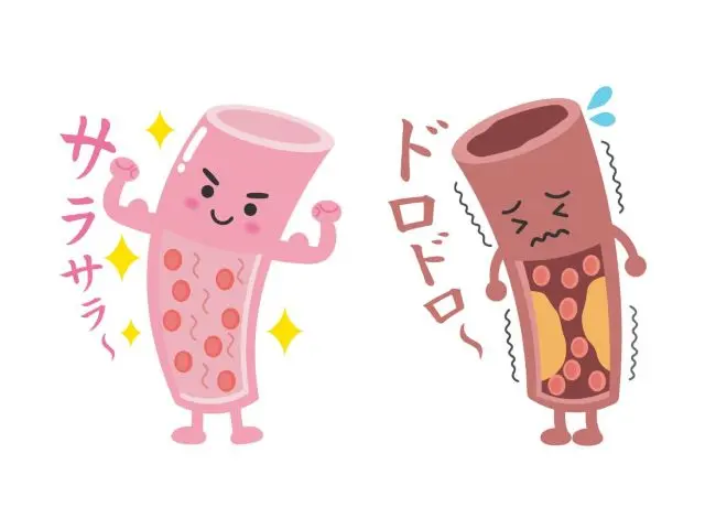 瘀血のイメージ図