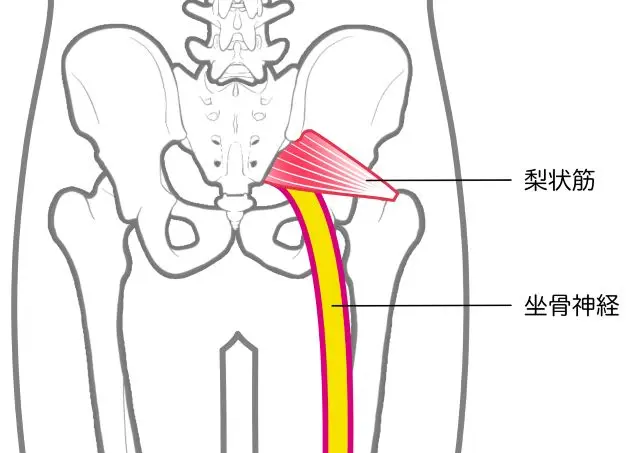 梨状筋と坐骨神経の位置を示す図