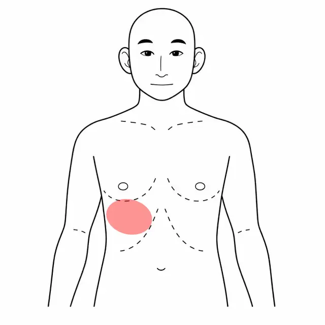 右肋間神経痛の位置を示す人体図（前面）