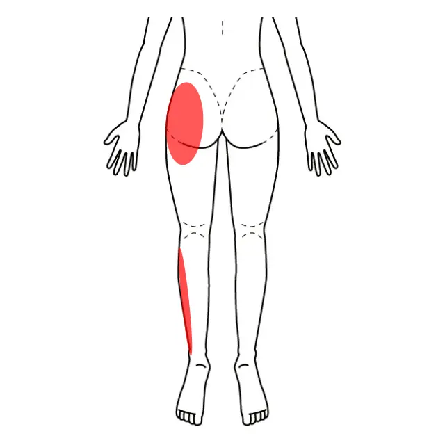 お尻と脛の外側の痛みとしびれの位置を示した図
