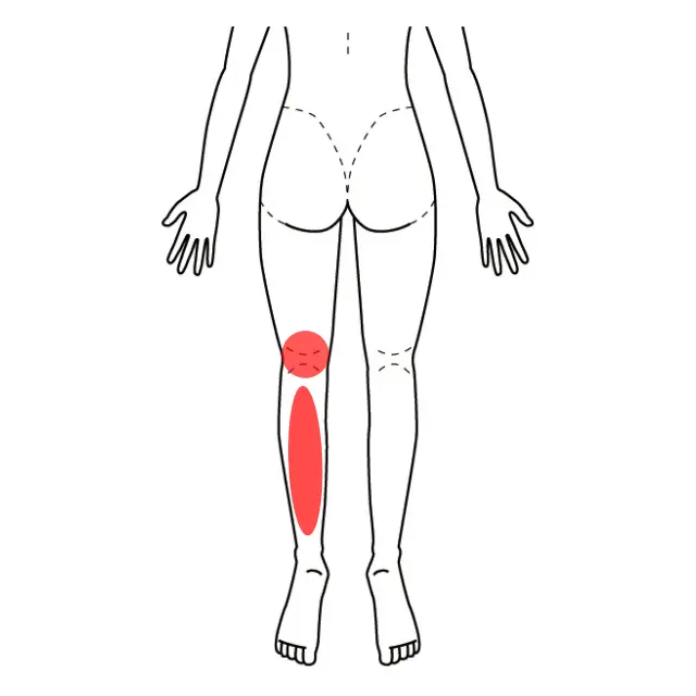左膝裏からふくらはぎの痛みを示した図