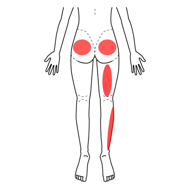 臀部、右太もも、脛の外側の痛みの位置を示した図