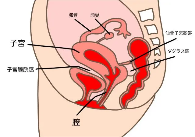 子宮内膜症の発生する部位を示した骨盤内腔の図
