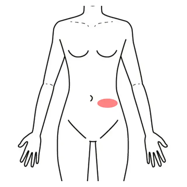 左脇腹から腹部の痛みの範囲を示した前面の人体図