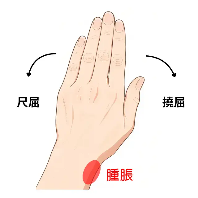 手首の状態を示す図