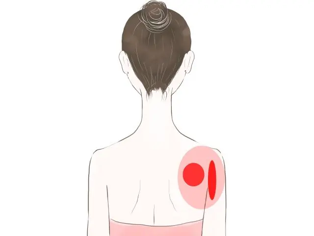 肩関節後面（肩甲骨上）の位置を示す人体図