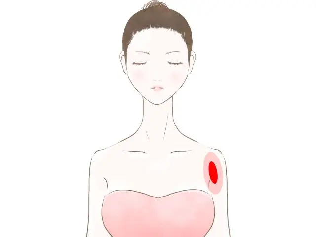肩関節前面の位置を示す人体図