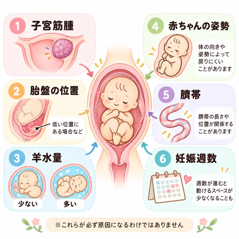 逆子が戻りにくい状態を示したイラスト